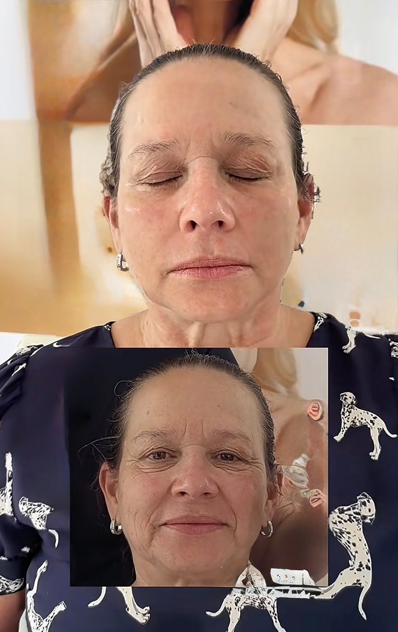 P-TIOX Anti-Wrinkle Serum